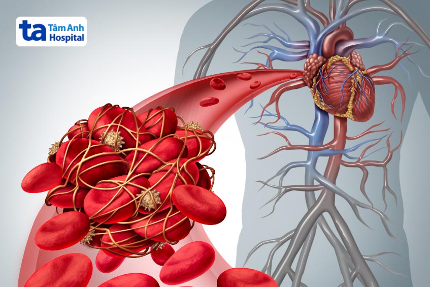 Động mạch là gì? Giải phẫu, chức năng, cấu tạo và vị trí nằm ở đâu