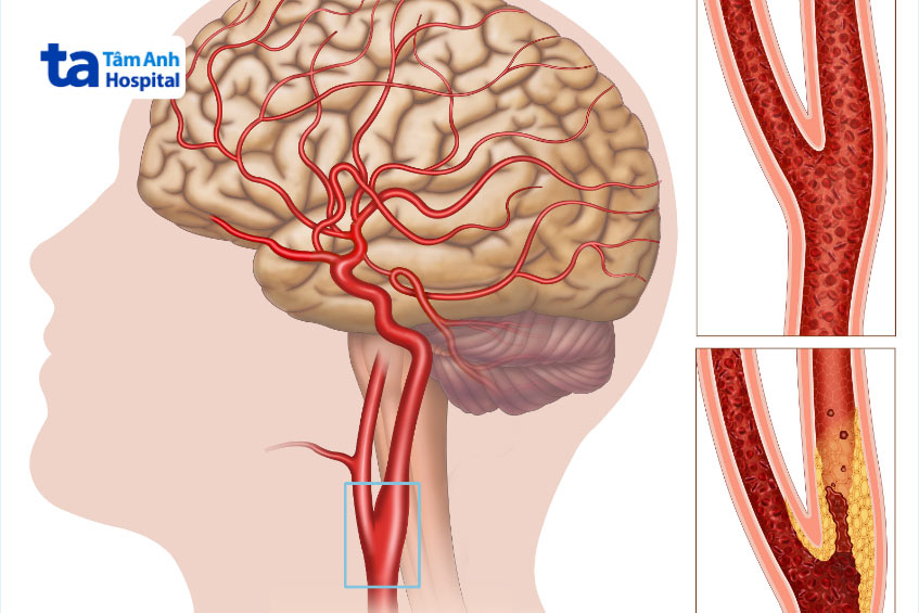 Động mạch là gì? Giải phẫu, chức năng, cấu tạo và vị trí nằm ở đâu