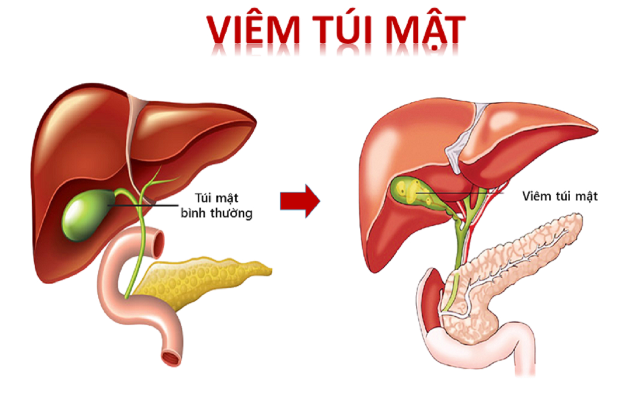 Phenyl Axetat Là Gì? Công Thức Cấu Tạo Và Cách Điều Chế