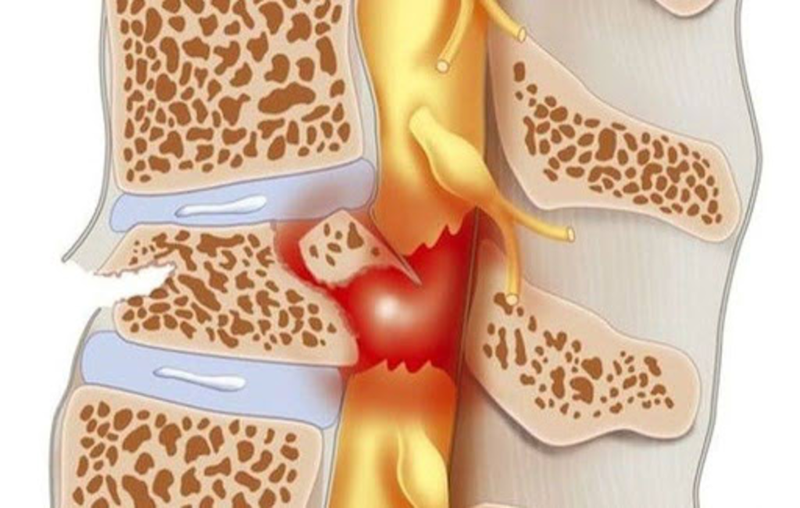 Chức năng của tủy sống và những điều cần biết