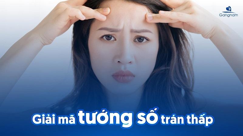 Trán ngắn (trán thấp) là gì? Tướng số và cách khắc phục trán ngắn hiệu quả