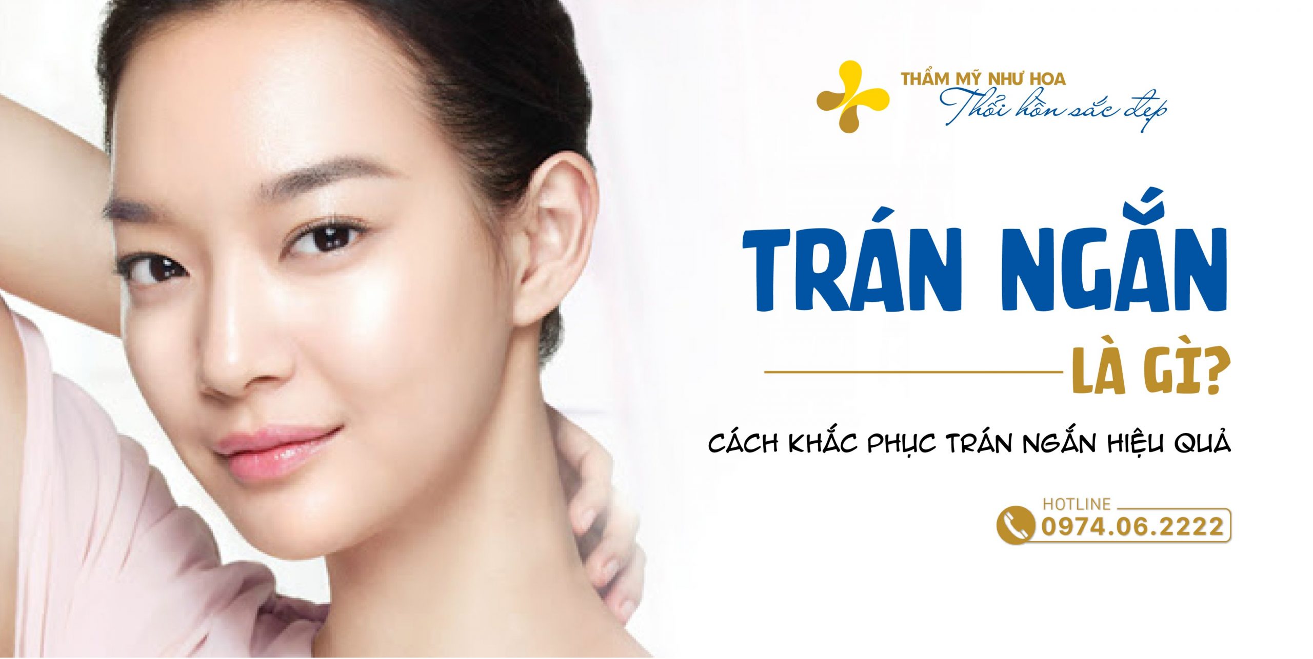 Trán ngắn (trán thấp) là gì? Cách khắc phục trán ngắn hiệu quả