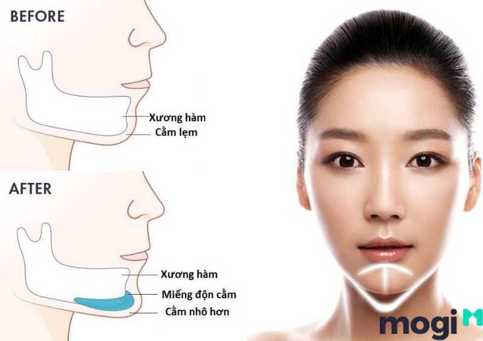 Khám Phá Tướng Mệnh Của Người Có Cằm Tròn Dựa Theo Nhân Tướng Học Chính Xác