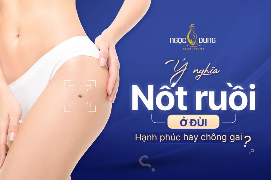 Ý nghĩa nốt ruồi ở đùi nam, nữ: Hạnh phúc hay chông gai?